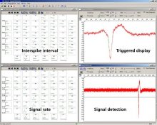 Event based analysis of cardiac activity
