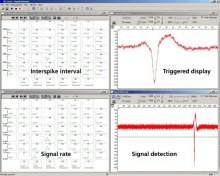 Event based analysis of cardiac activity