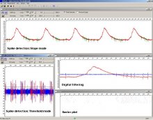 MicroERG's and spikes (Retina) MicroERG's and spikes (Retina)