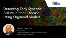 Webinar-Detecting-Early-Synaptic-Failure-in-Prion-Disease-Using-Organoid-Models-by-InsideScientific-MultiChannelSystems-HBio-Simote-Foliaki
