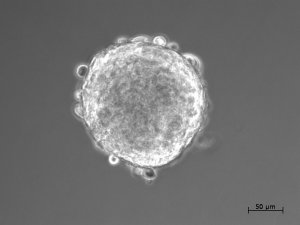 beta cell islet