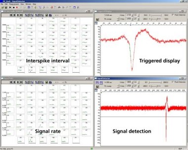 Event based analysis of cardiac activity