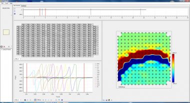 Cardio2D+ Main Window