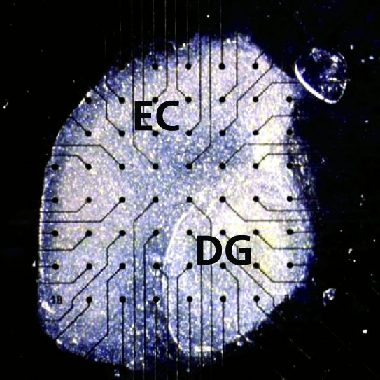Hippocampal Slices for Organotypic Cultures (OTC)